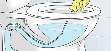 رفع گرفتگی شتر گلو توالت چگونه انجام می‌شود؟ علت آن چیست؟